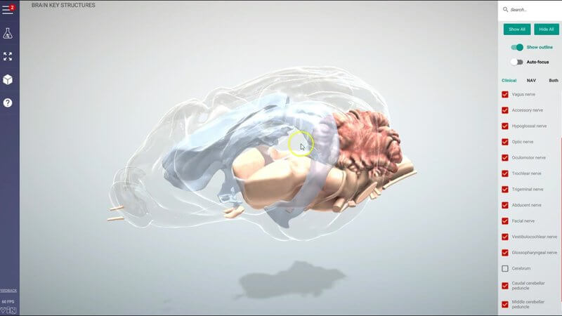 Canine brain in the IVALA Learn 3D viewer made semi-transparent to show the ventricles alongside the brainstem and cerebellum