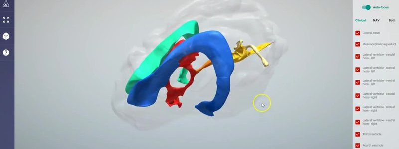 Ventricular system of the canine brain in the IVALA Learn 3D viewer, with each part of the system colour coded inside a transparent brain