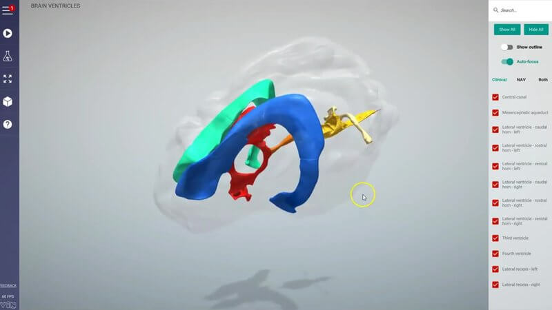 Ventricular system of the canine brain in the IVALA Learn 3D viewer, with each part of the system colour coded inside a transparent brain
