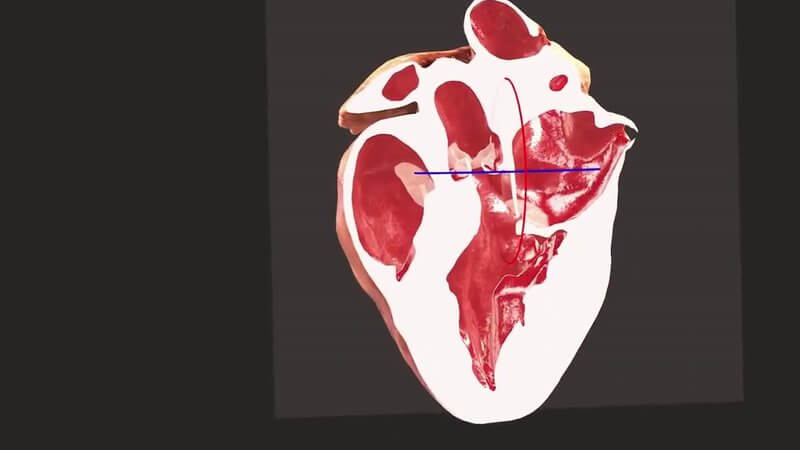 3D canine heart sectioned lengthways by the movable plane in the IVALA Learn Heart Live Section, revealing the chambers and valves