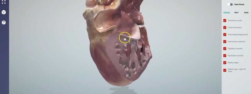 Canine heart in the IVALA Learn 3D viewer with the right ventricular wall removed to show the papillary muscles and chordae tendineae