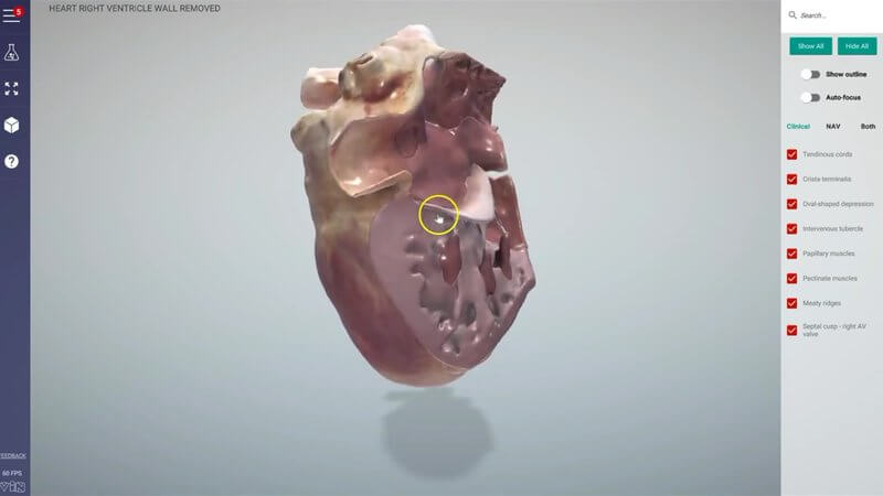 Canine heart in the IVALA Learn 3D viewer with the right ventricular wall removed to show the papillary muscles and chordae tendineae