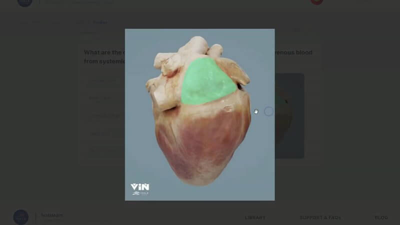 Enlarged image of a canine heart with one region highlighted in green, from a multiple choice question in the IVALA Learn canine thoracic anatomy course