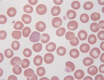 Red Blood Cell Physiology
