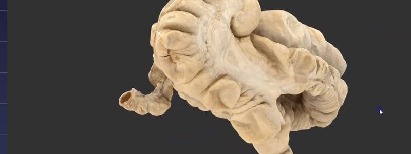 Scanned equine large intestine in the IVALA Learn 3D viewer, showing the caecum, the sacculated colon and the taenial bands