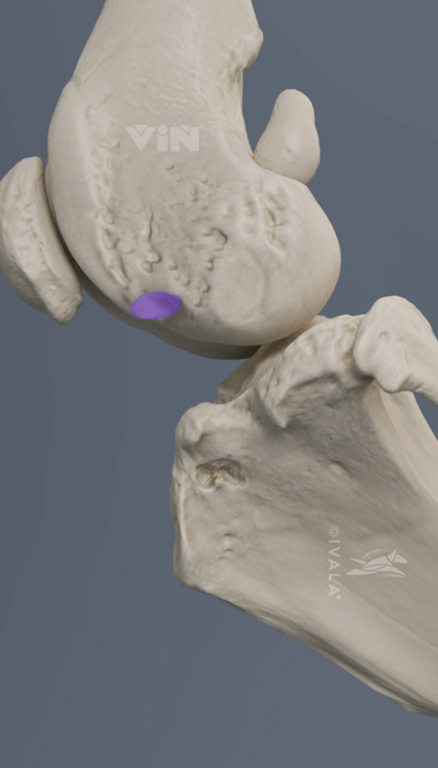 Extensor fossa of femur